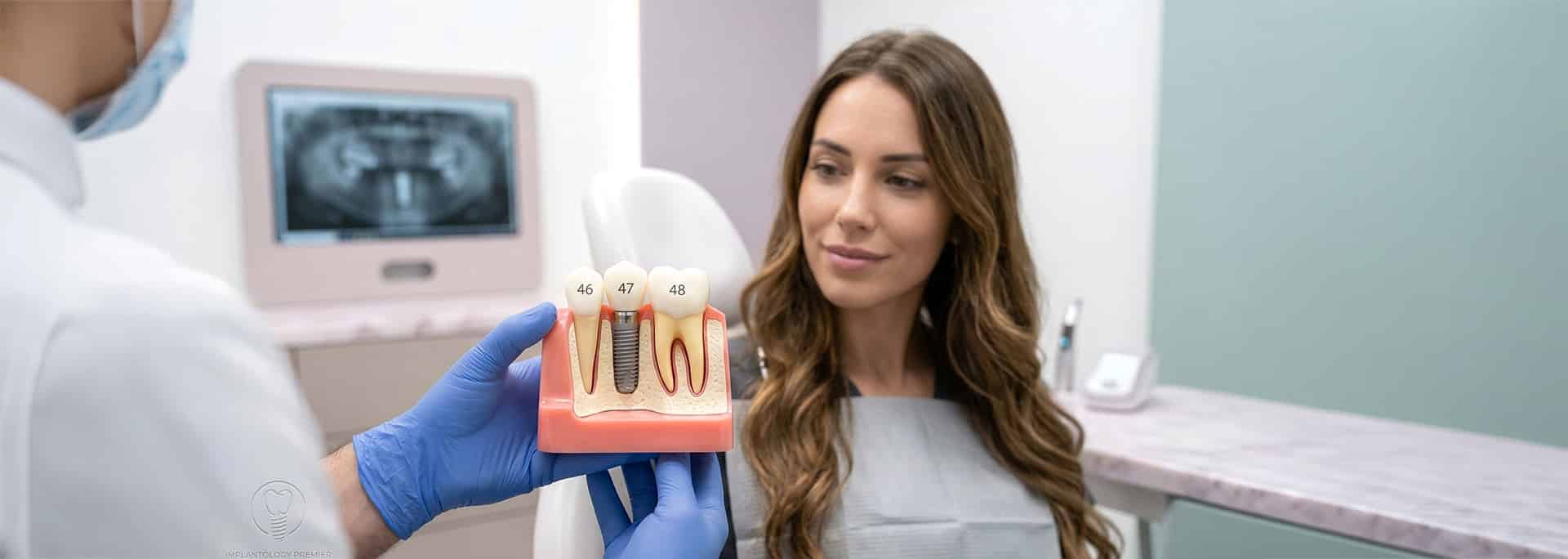 Dental implants in Kochi – permanent teeth replacement at Mazhuvenchery Speciality Dental Clinic