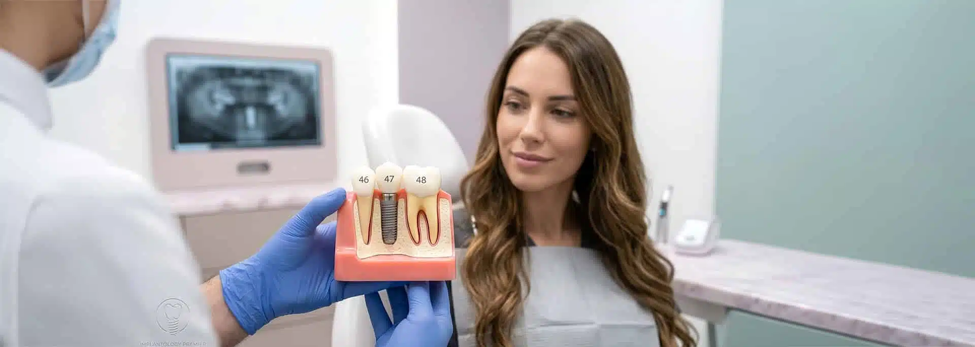 Dental implants in Kochi – permanent teeth replacement at Mazhuvenchery Speciality Dental Clinic