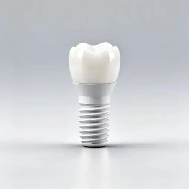 Dental implant for permanent tooth replacement in Kochi dental clinic