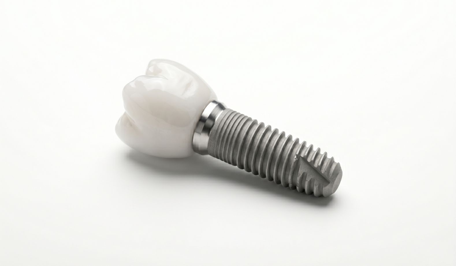Dental implants in Kochi for permanent tooth replacement