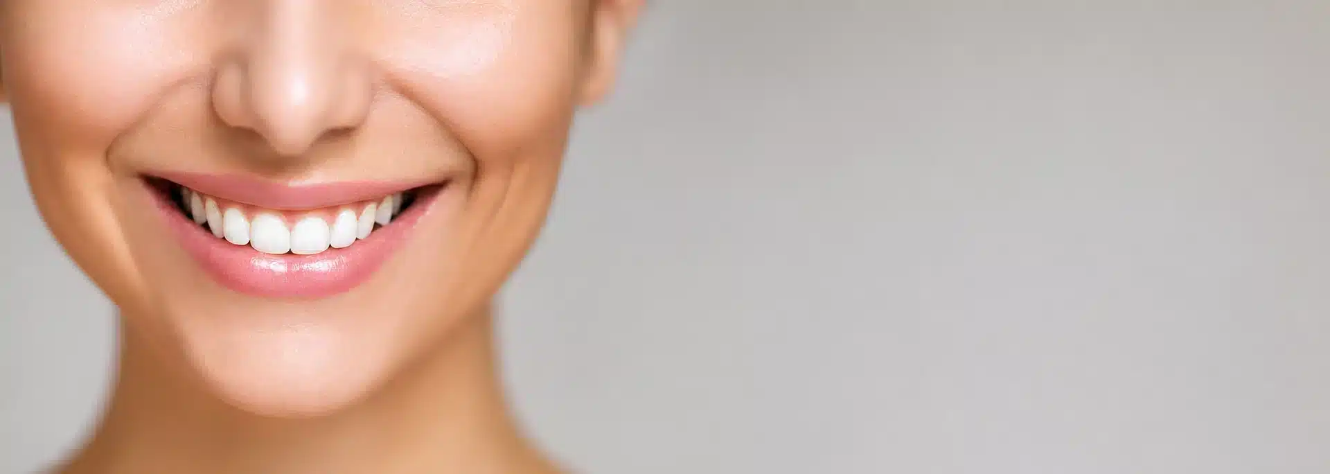 Teeth Whitening and Smile Makeover in Kochi Professional teeth whitening and smile makeover result at Mazhuvenchery dental clinic in Kochi showing bright natural white smile